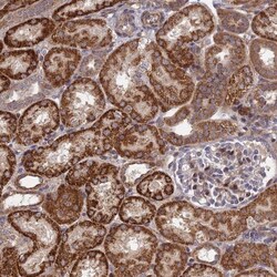 PLEKHG2 Antibody, Novus Biologicals 0.1mL; Unlabeled:Antibodies, Polyclonal